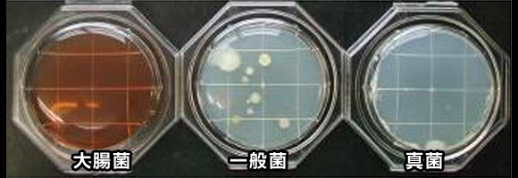 加工者Aの手菌の繁殖画像